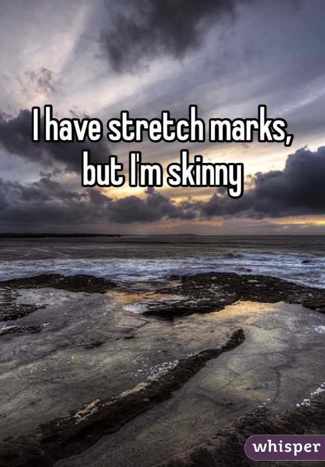 I have stretch marks, 
but I'm skinny