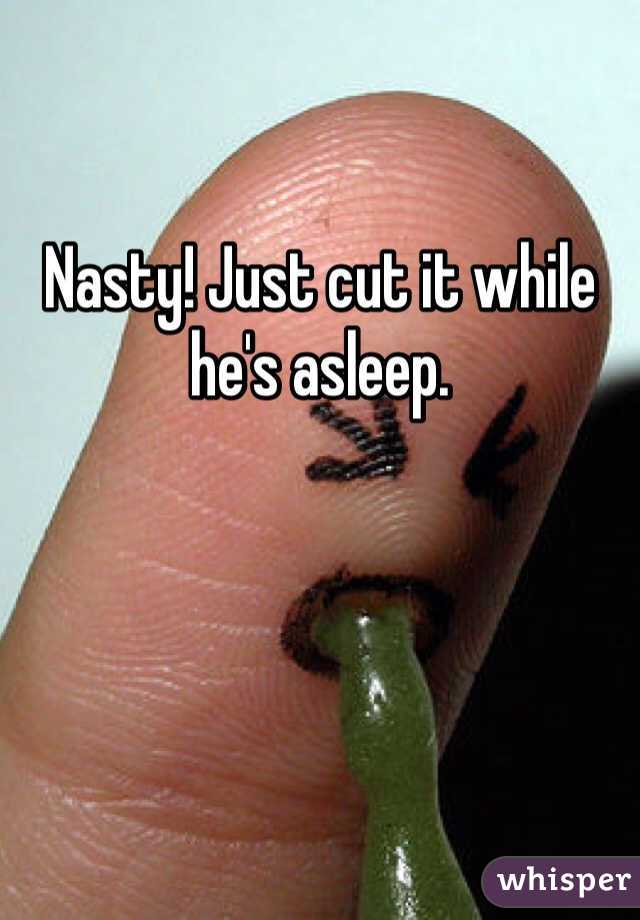 Nasty! Just cut it while he's asleep.