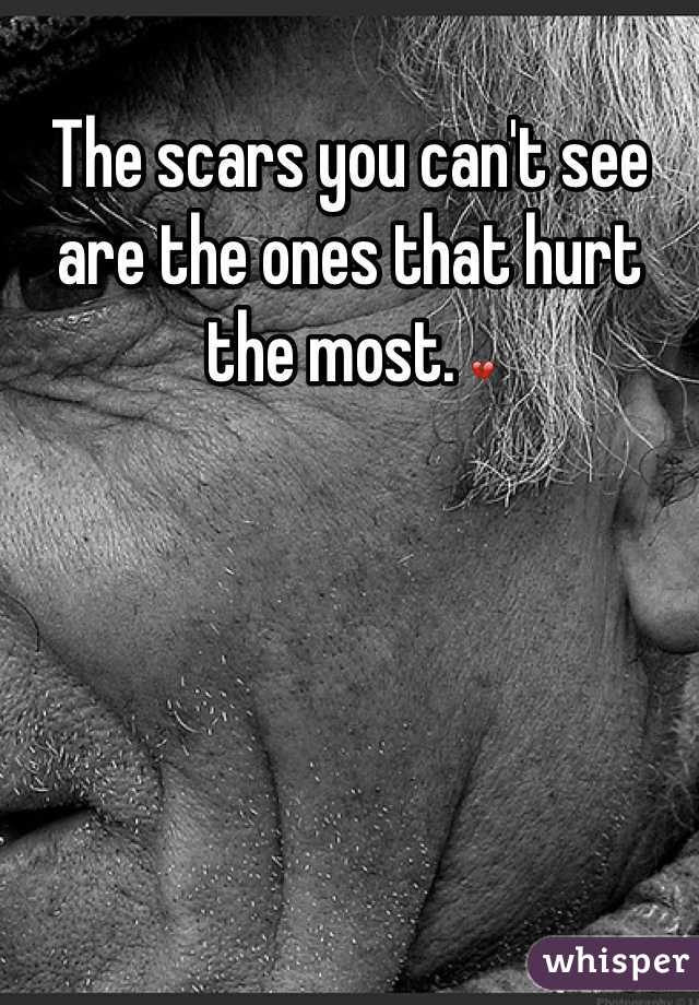 The scars you can't see are the ones that hurt the most. 💔