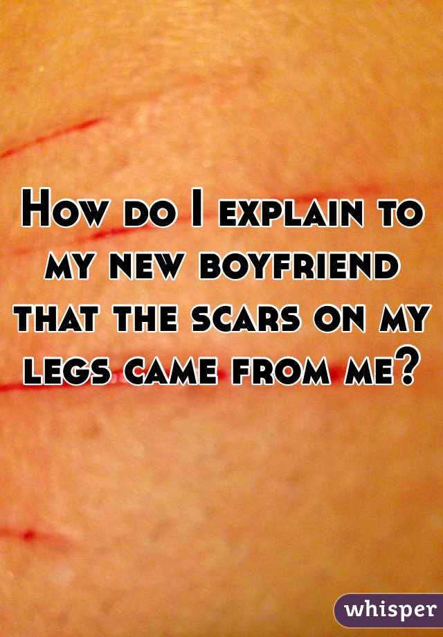 How do I explain to my new boyfriend that the scars on my legs came from me?