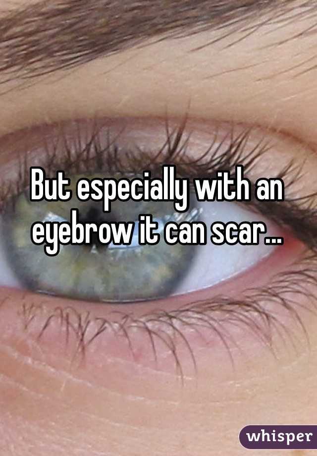 But especially with an eyebrow it can scar... 