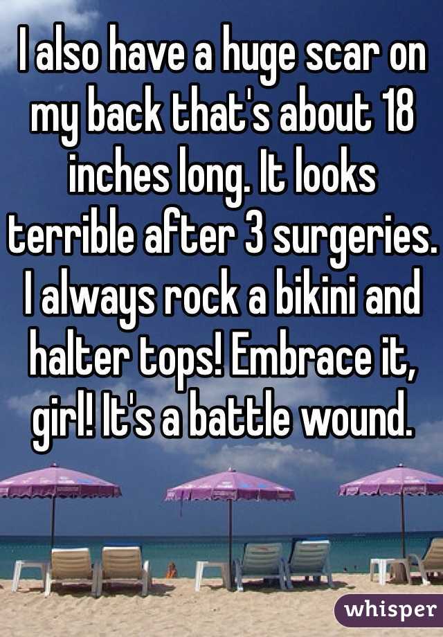 I also have a huge scar on my back that's about 18 inches long. It looks terrible after 3 surgeries. I always rock a bikini and halter tops! Embrace it, girl! It's a battle wound. 