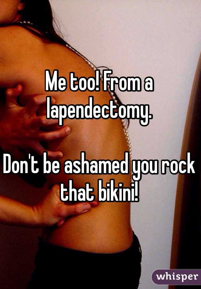 Me too! From a lapendectomy. 

Don't be ashamed you rock that bikini!
