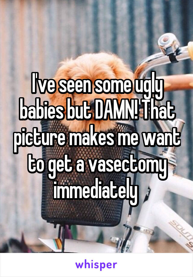 I've seen some ugly babies but DAMN! That picture makes me want to get a vasectomy immediately 