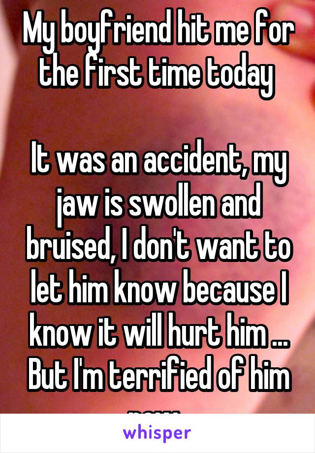My boyfriend hit me for the first time today 

It was an accident, my jaw is swollen and bruised, I don't want to let him know because I know it will hurt him ... But I'm terrified of him now. 