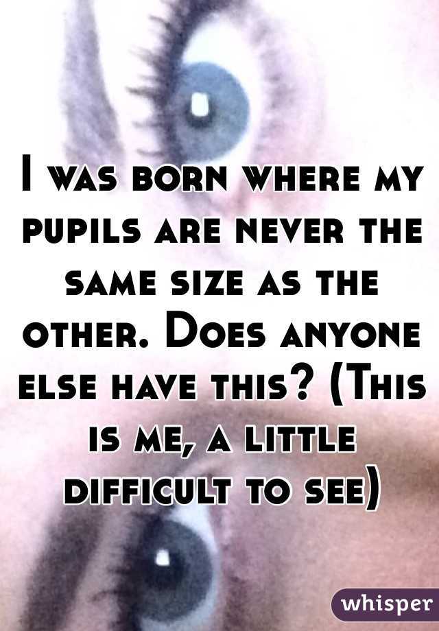 I was born where my pupils are never the same size as the other. Does anyone else have this? (This is me, a little difficult to see)