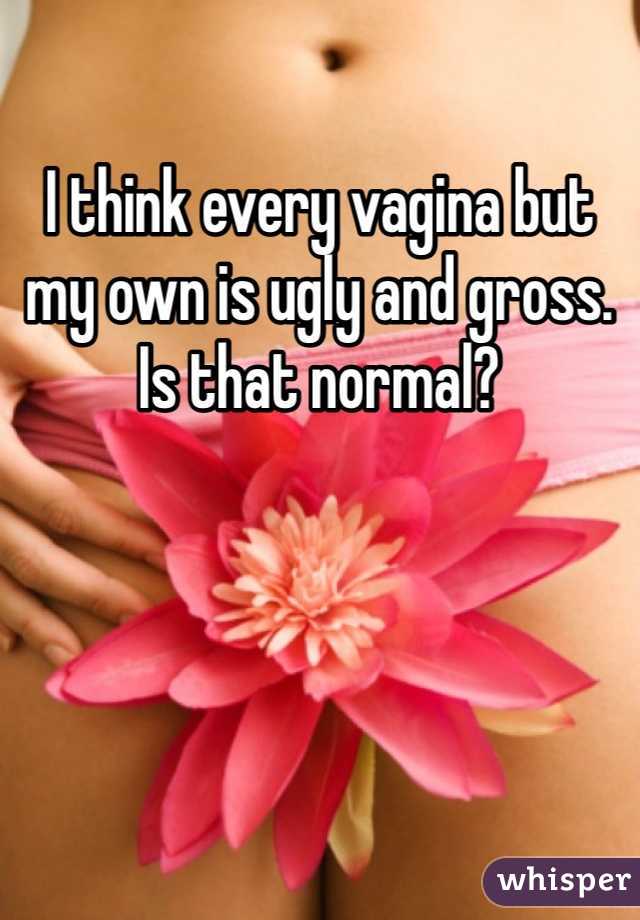 I think every vagina but my own is ugly and gross. Is that normal? 