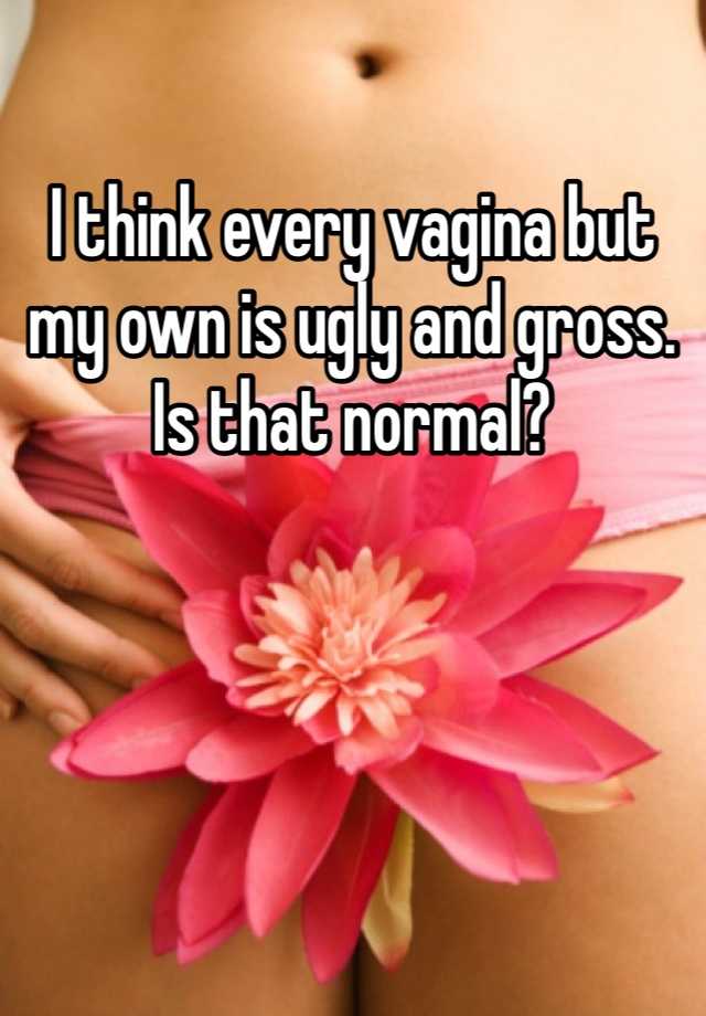 I think every vagina but my own is ugly and gross. Is that normal? 