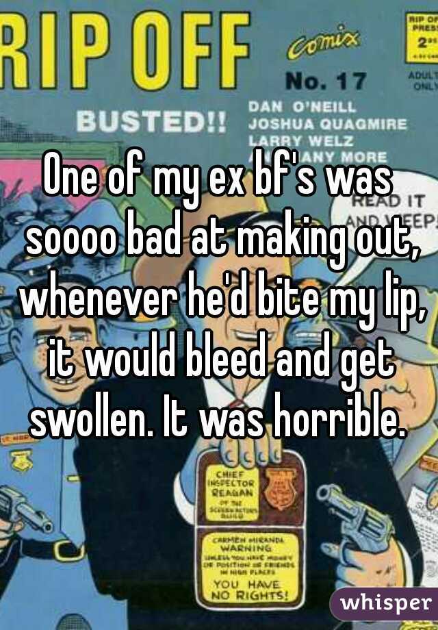 One of my ex bf's was soooo bad at making out, whenever he'd bite my lip, it would bleed and get swollen. It was horrible. 