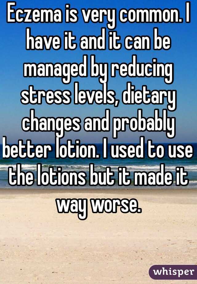 Eczema is very common. I have it and it can be managed by reducing stress levels, dietary changes and probably better lotion. I used to use the lotions but it made it way worse. 