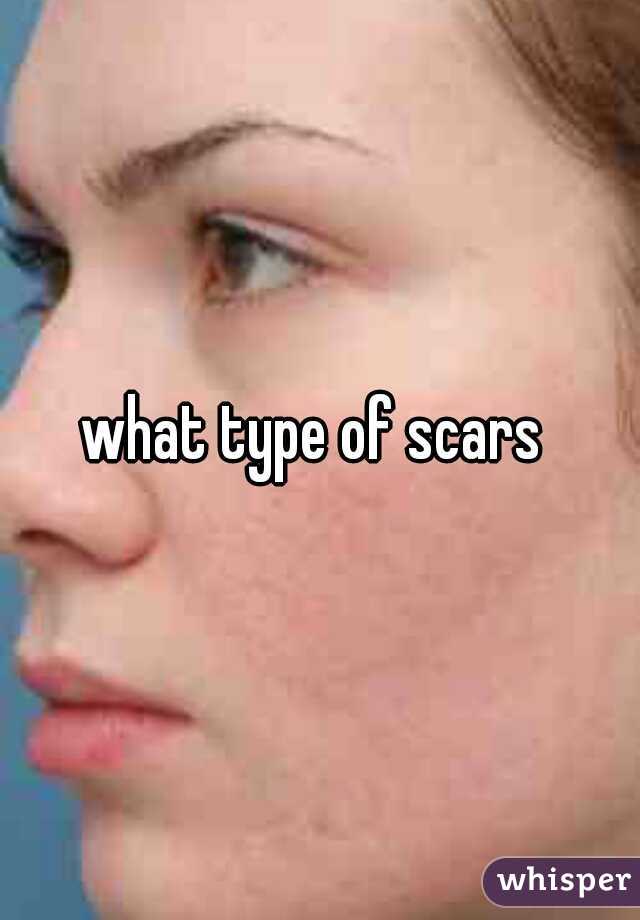 what type of scars 