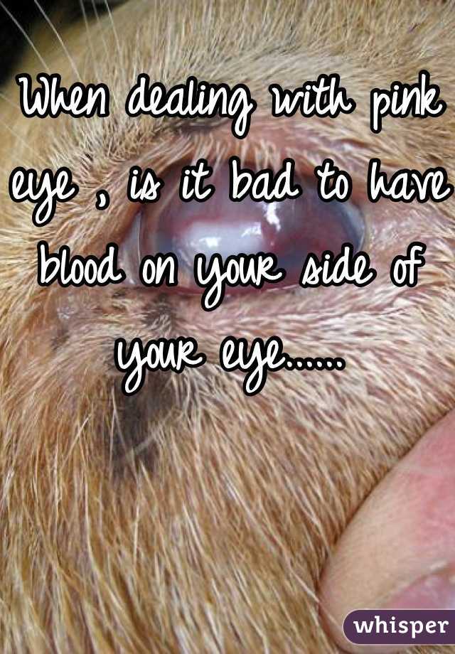 When dealing with pink eye , is it bad to have blood on your side of your eye......