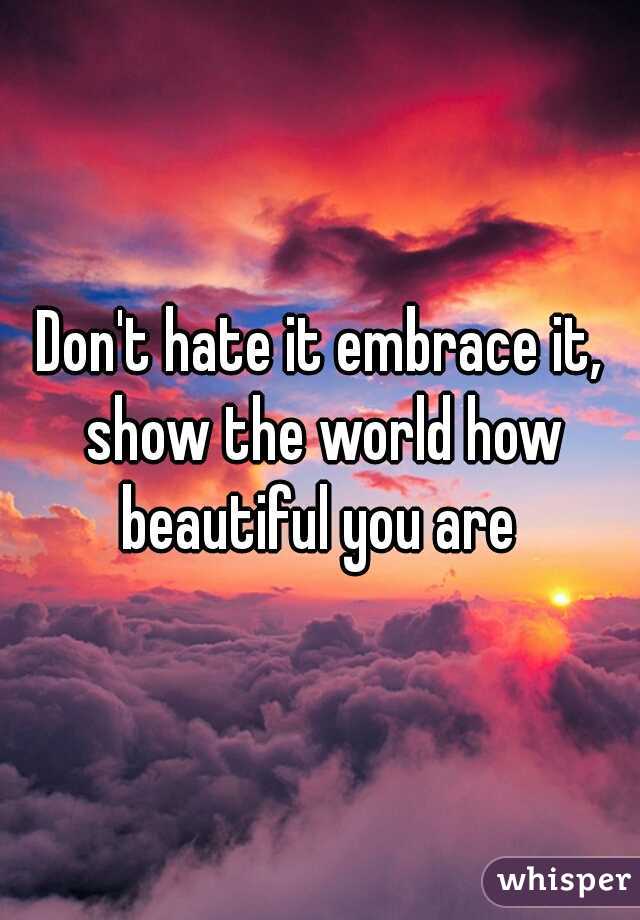 Don't hate it embrace it, show the world how beautiful you are 