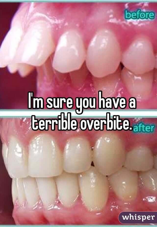 I'm sure you have a terrible overbite.