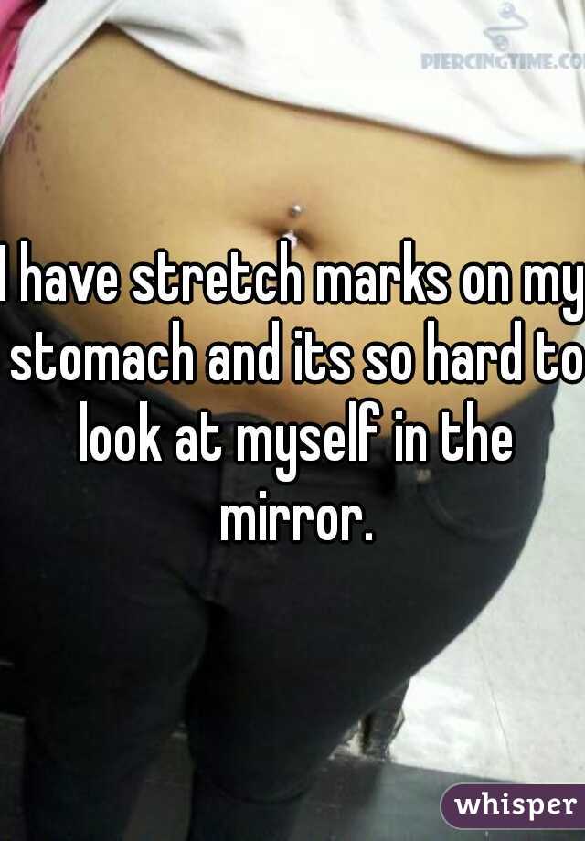 I have stretch marks on my stomach and its so hard to look at myself in the mirror.