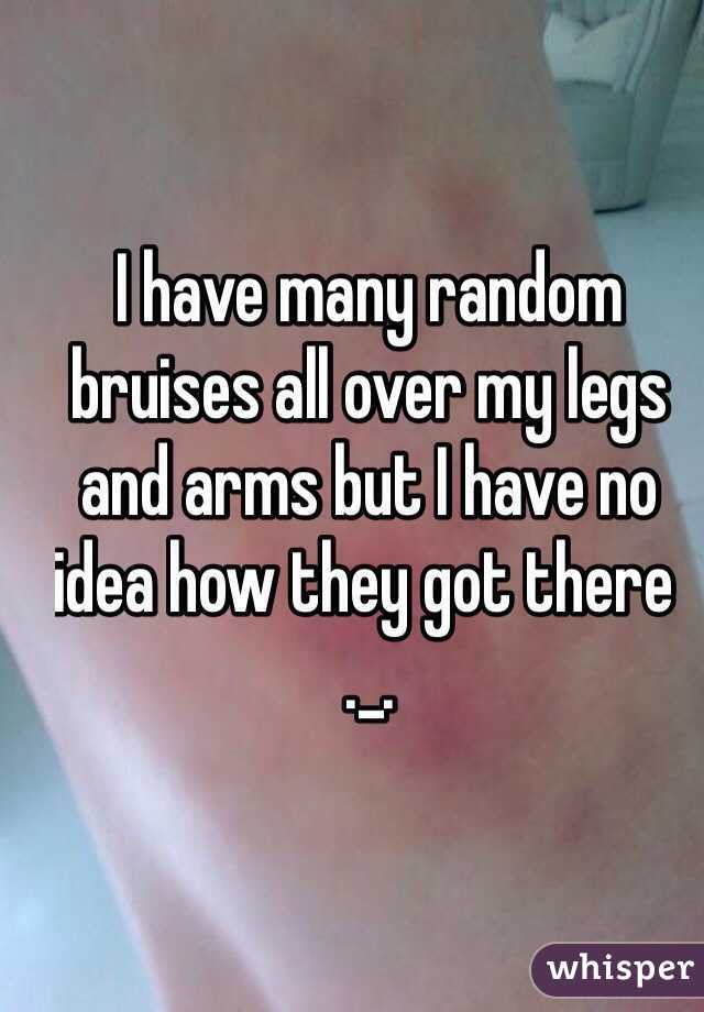 I have many random bruises all over my legs and arms but I have no idea how they got there ._. 