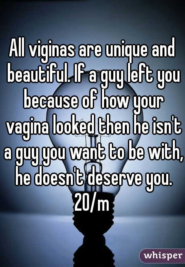 All viginas are unique and beautiful. If a guy left you because of how your vagina looked then he isn't a guy you want to be with, he doesn't deserve you.
20/m