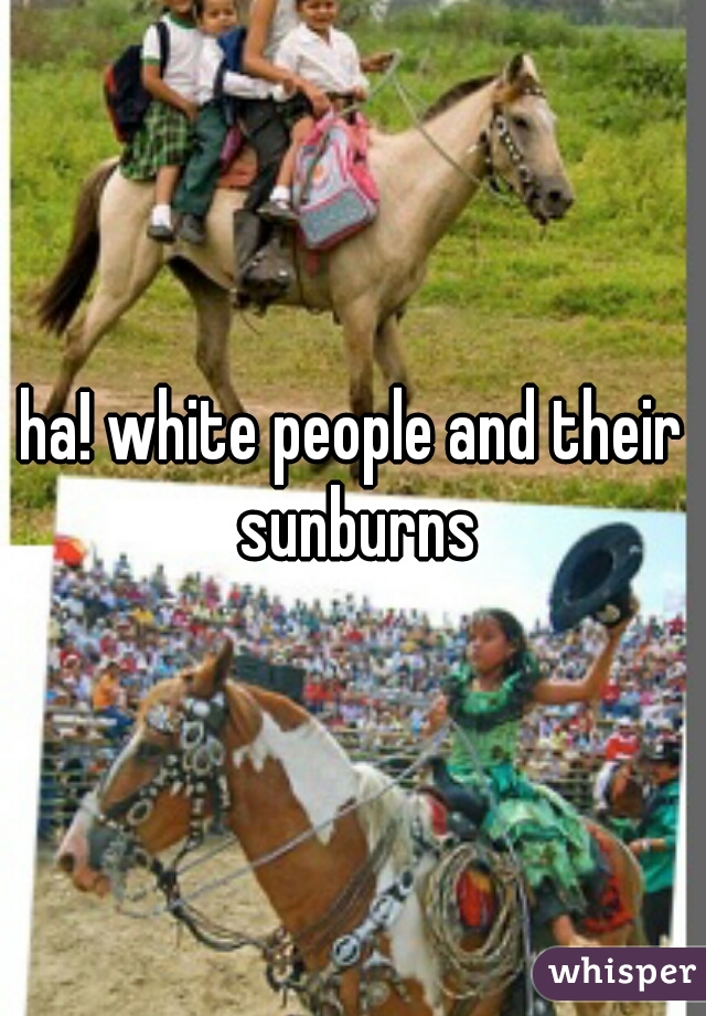 ha! white people and their sunburns