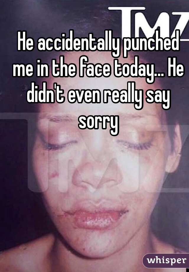 He accidentally punched me in the face today... He didn't even really say sorry