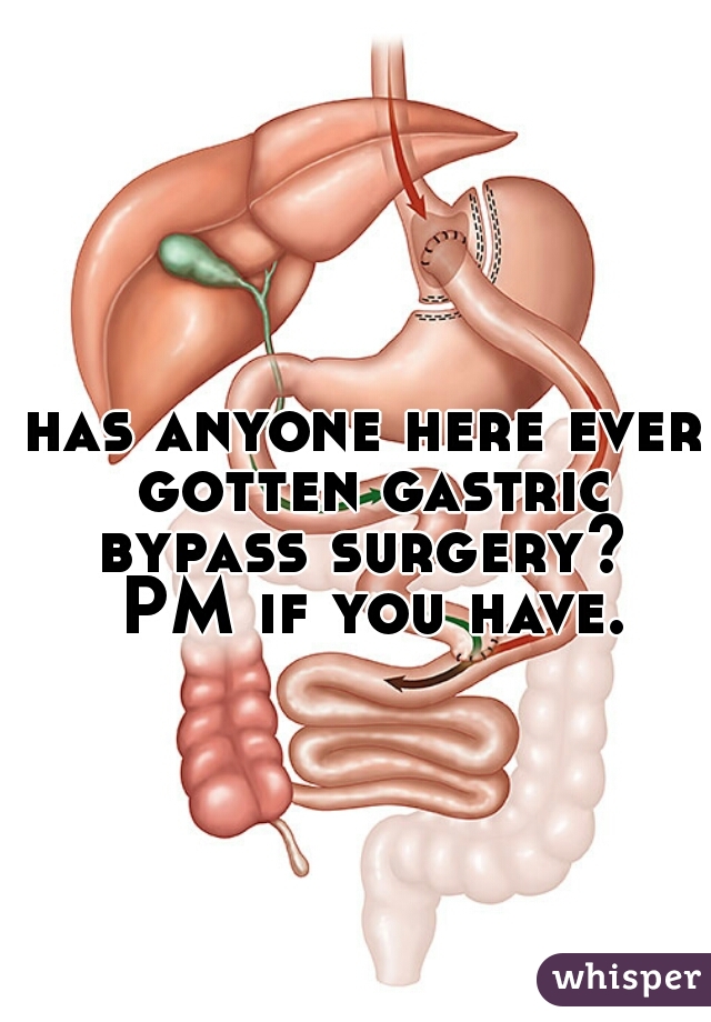 has anyone here ever gotten gastric bypass surgery?  PM if you have.