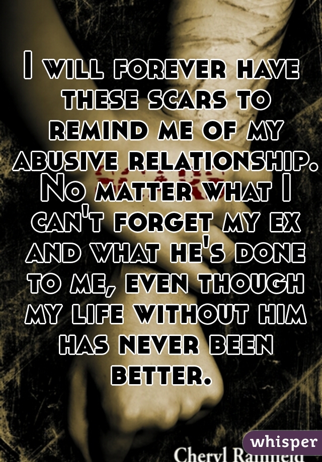 I will forever have these scars to remind me of my abusive relationship. No matter what I can't forget my ex and what he's done to me, even though my life without him has never been better. 