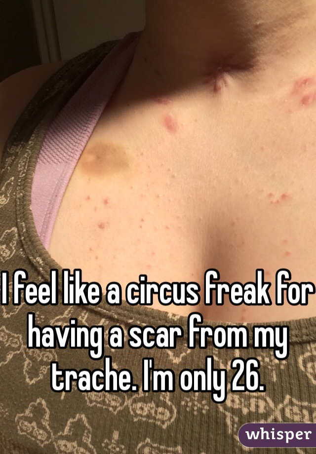 





I feel like a circus freak for having a scar from my trache. I'm only 26.