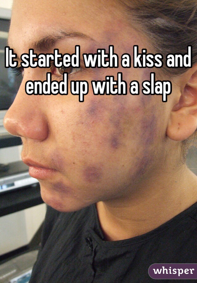 It started with a kiss and ended up with a slap