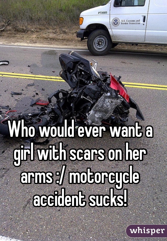 Who would ever want a girl with scars on her arms :/ motorcycle accident sucks! 