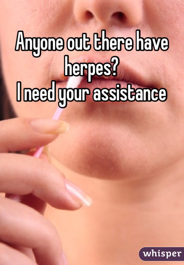 Anyone out there have herpes?
I need your assistance 