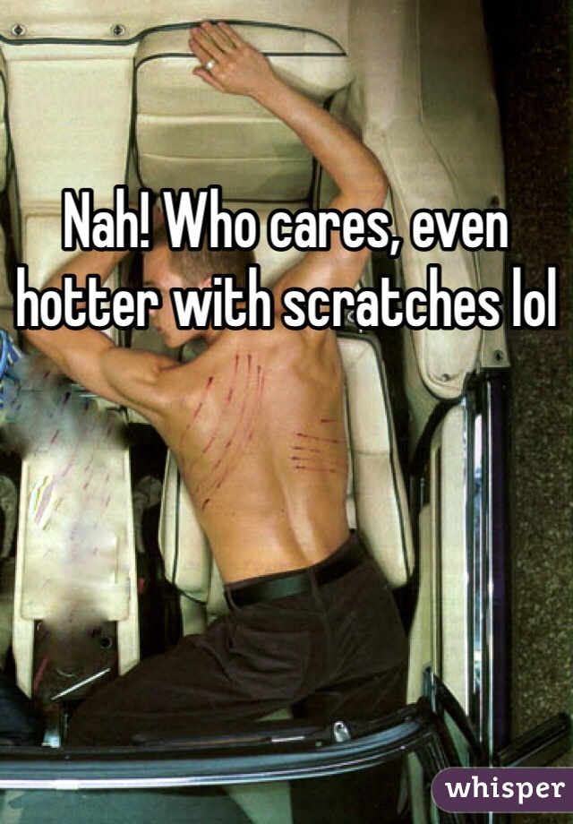 Nah! Who cares, even hotter with scratches lol