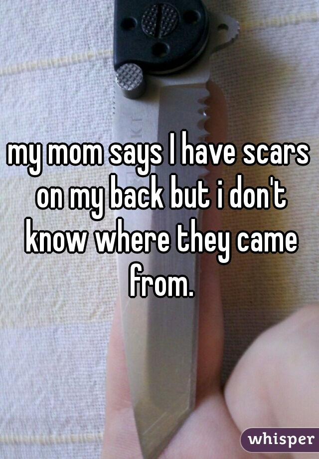 my mom says I have scars on my back but i don't know where they came from.