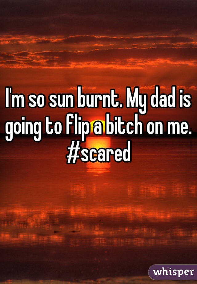 I'm so sun burnt. My dad is going to flip a bitch on me. #scared