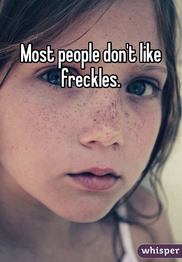 Most people don't like freckles. 