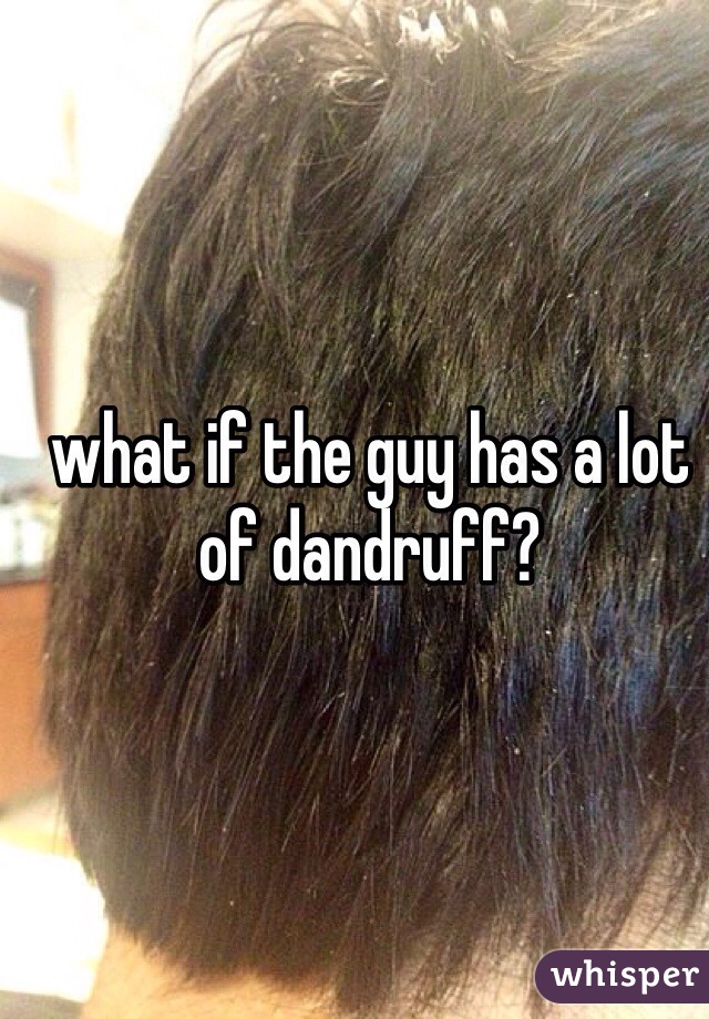 what if the guy has a lot of dandruff? 