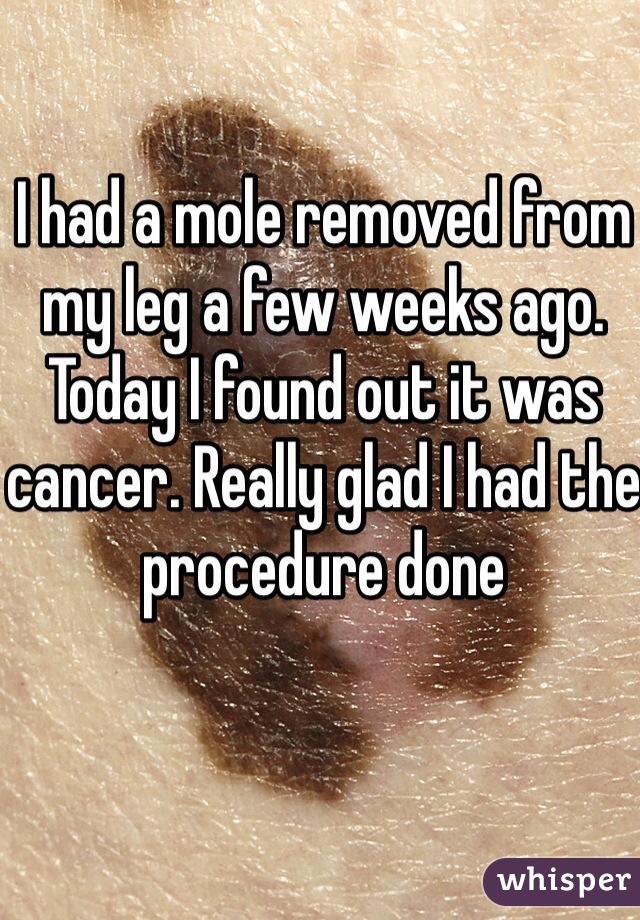 I had a mole removed from my leg a few weeks ago. Today I found out it was cancer. Really glad I had the procedure done 