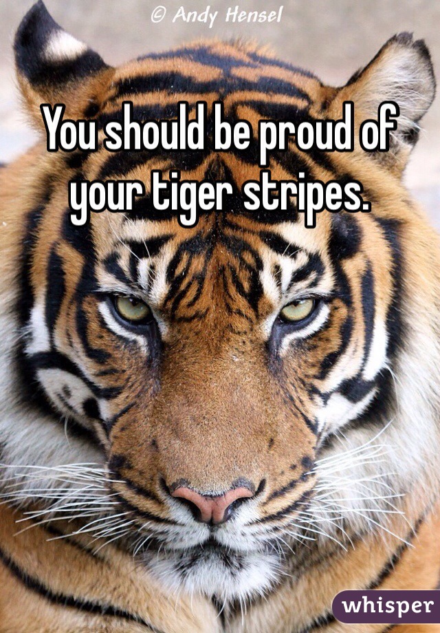 You should be proud of your tiger stripes. 