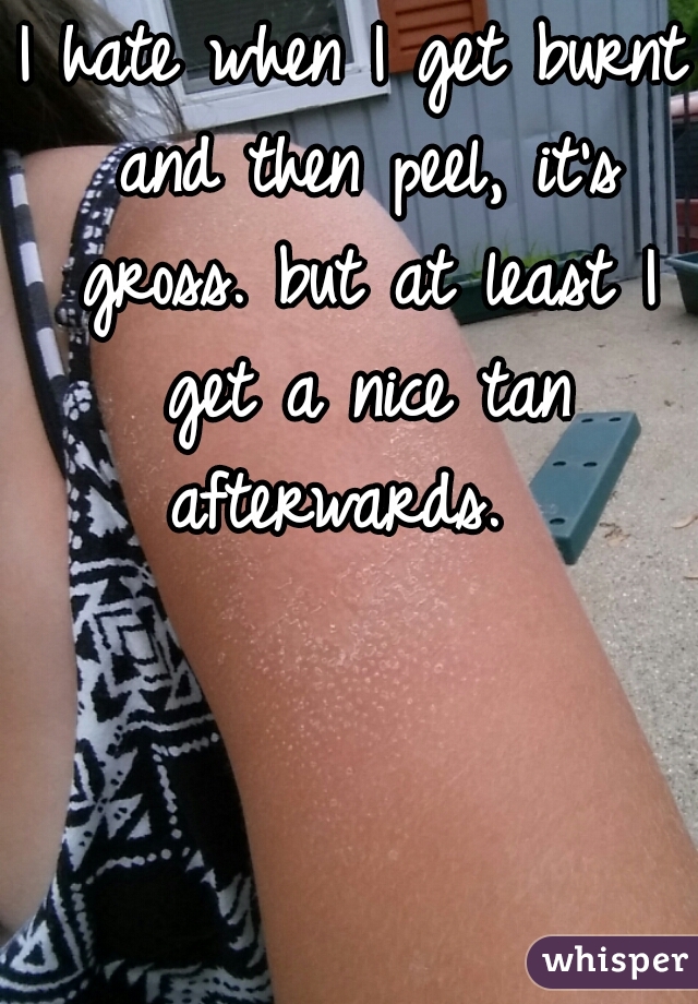 I hate when I get burnt and then peel, it's gross. but at least I get a nice tan afterwards.  