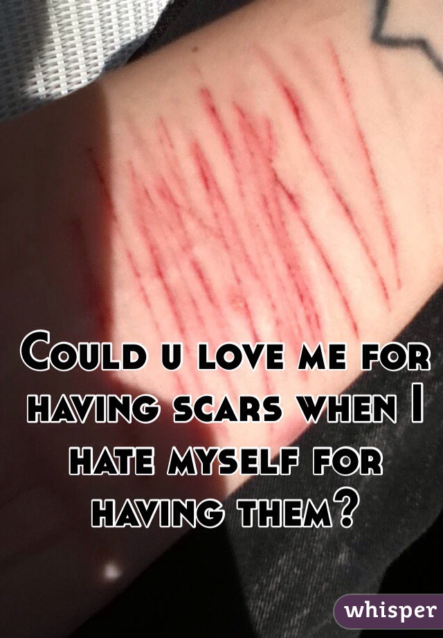 Could u love me for having scars when I hate myself for having them? 