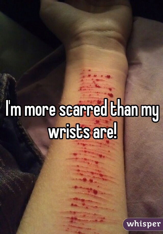 I'm more scarred than my wrists are! 