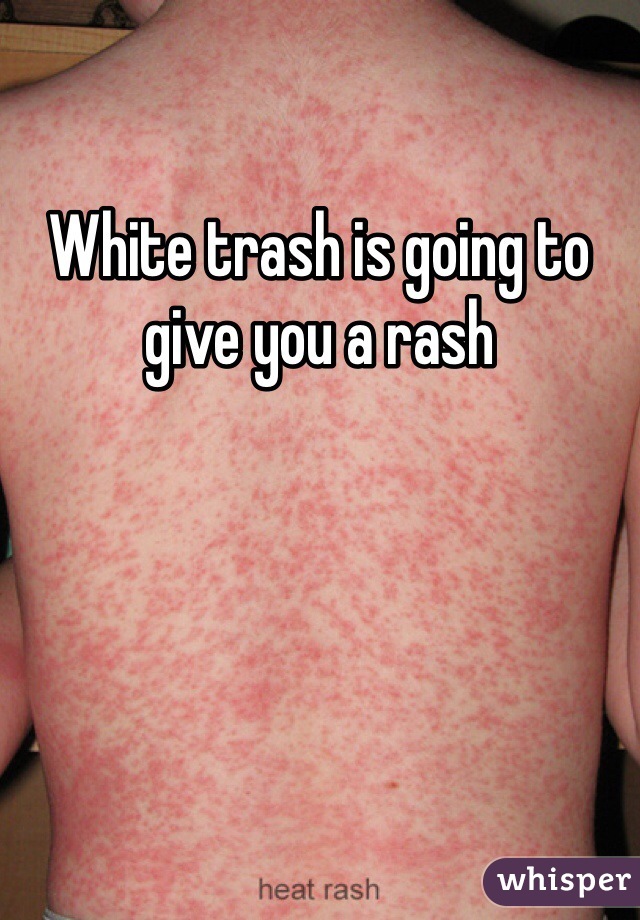 White trash is going to give you a rash 