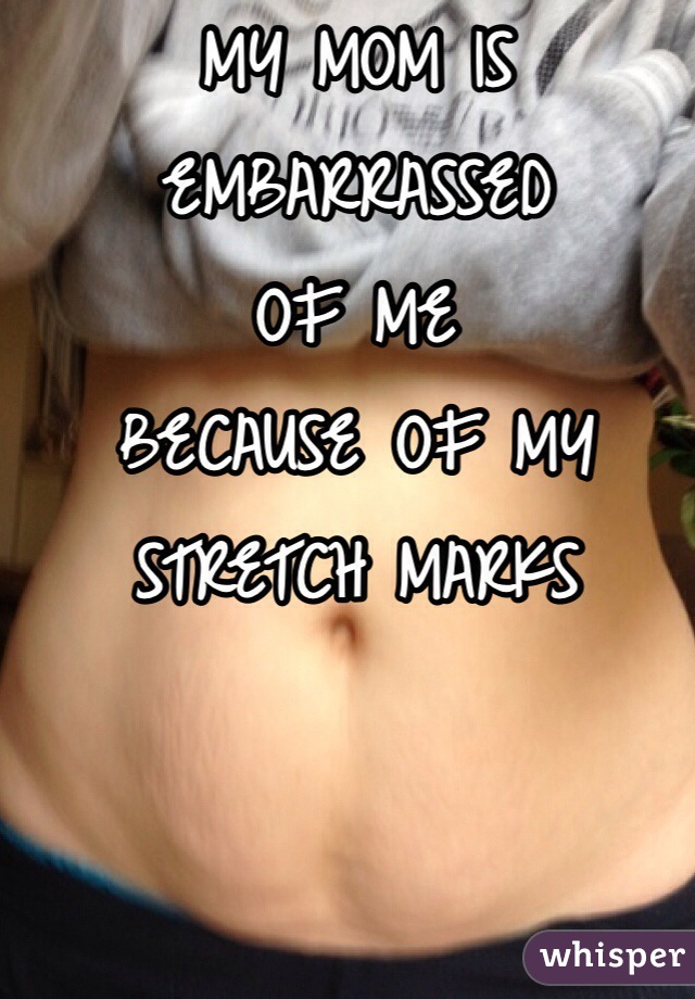 MY MOM IS
EMBARRASSED 
OF ME
BECAUSE OF MY
STRETCH MARKS 