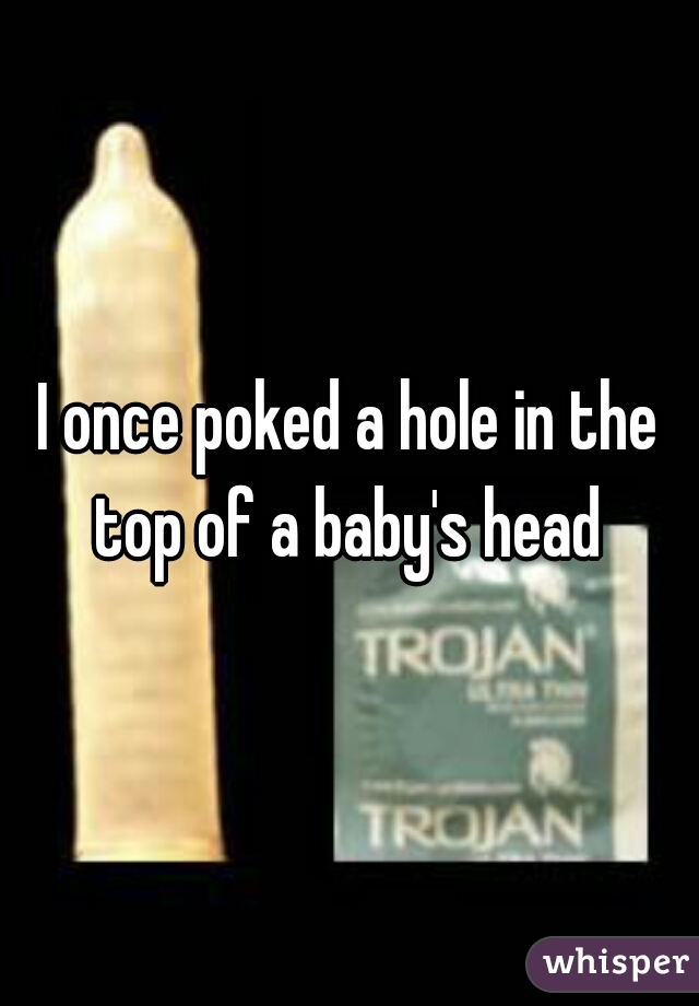 I once poked a hole in the top of a baby's head 