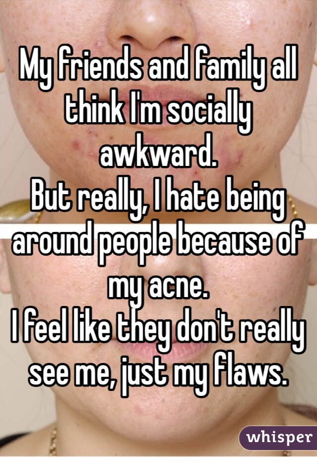 My friends and family all think I'm socially awkward. 
But really, I hate being around people because of my acne. 
I feel like they don't really see me, just my flaws. 
