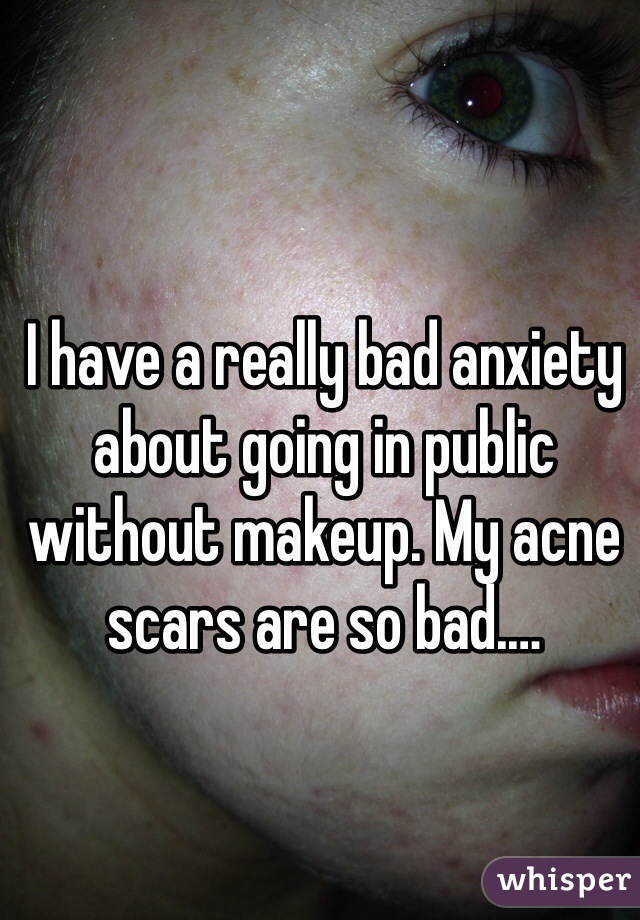 I have a really bad anxiety about going in public without makeup. My acne scars are so bad.…