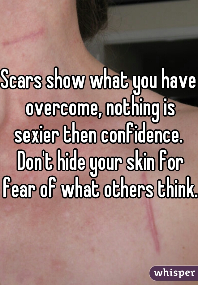 Scars show what you have overcome, nothing is sexier then confidence.  Don't hide your skin for fear of what others think.