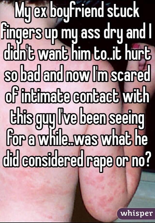 My ex boyfriend stuck fingers up my ass dry and I didn't want him to..it hurt so bad and now I'm scared of intimate contact with this guy I've been seeing for a while..was what he did considered rape or no? 