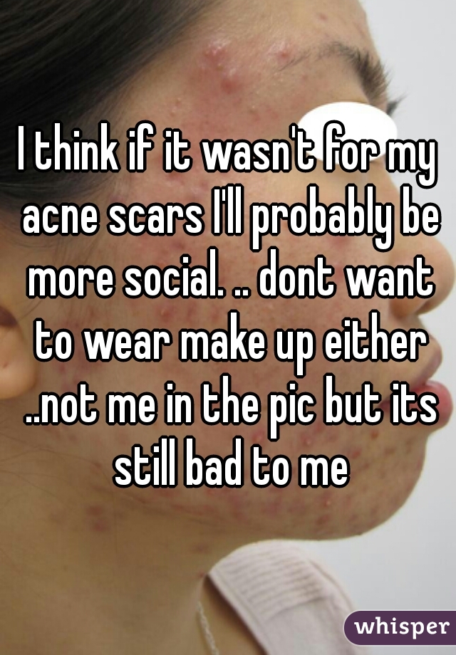 I think if it wasn't for my acne scars I'll probably be more social. .. dont want to wear make up either ..not me in the pic but its still bad to me