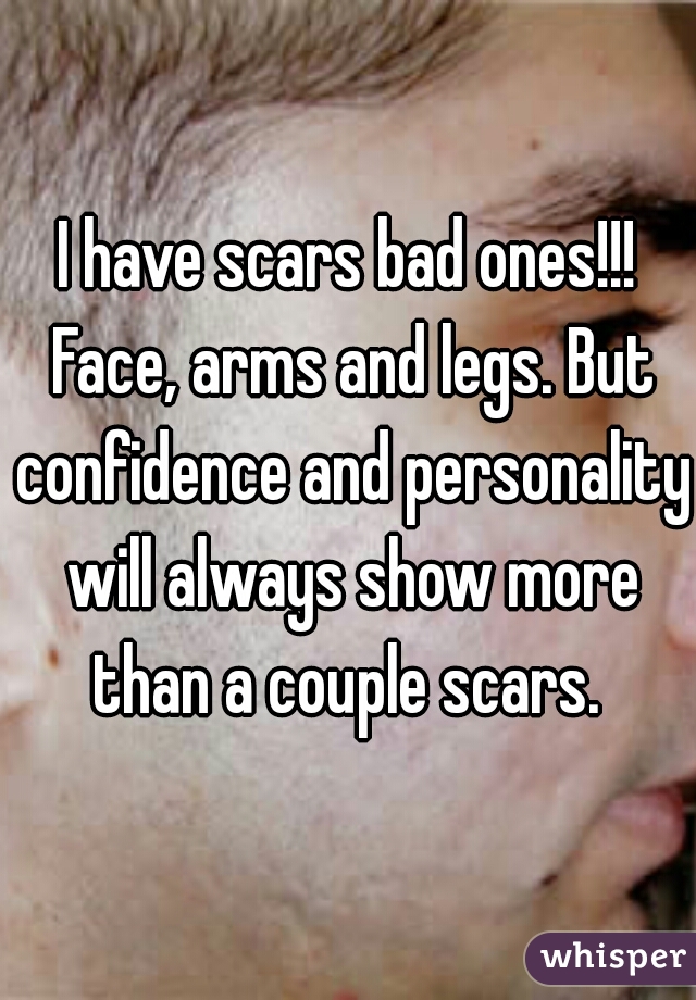 I have scars bad ones!!! Face, arms and legs. But confidence and personality will always show more than a couple scars. 