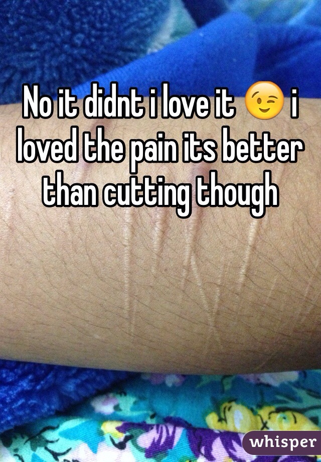 No it didnt i love it 😉 i loved the pain its better than cutting though