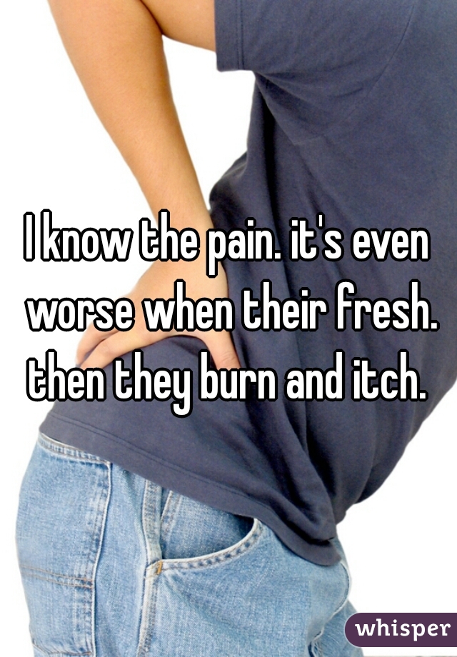 I know the pain. it's even worse when their fresh. then they burn and itch. 